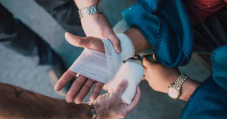 Swollen bandaged hand after a cat bite showing signs of infection